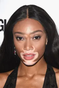 Photo Winnie Harlow