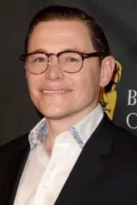 Photo Burn Gorman