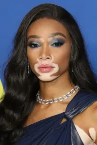 Photo Winnie Harlow