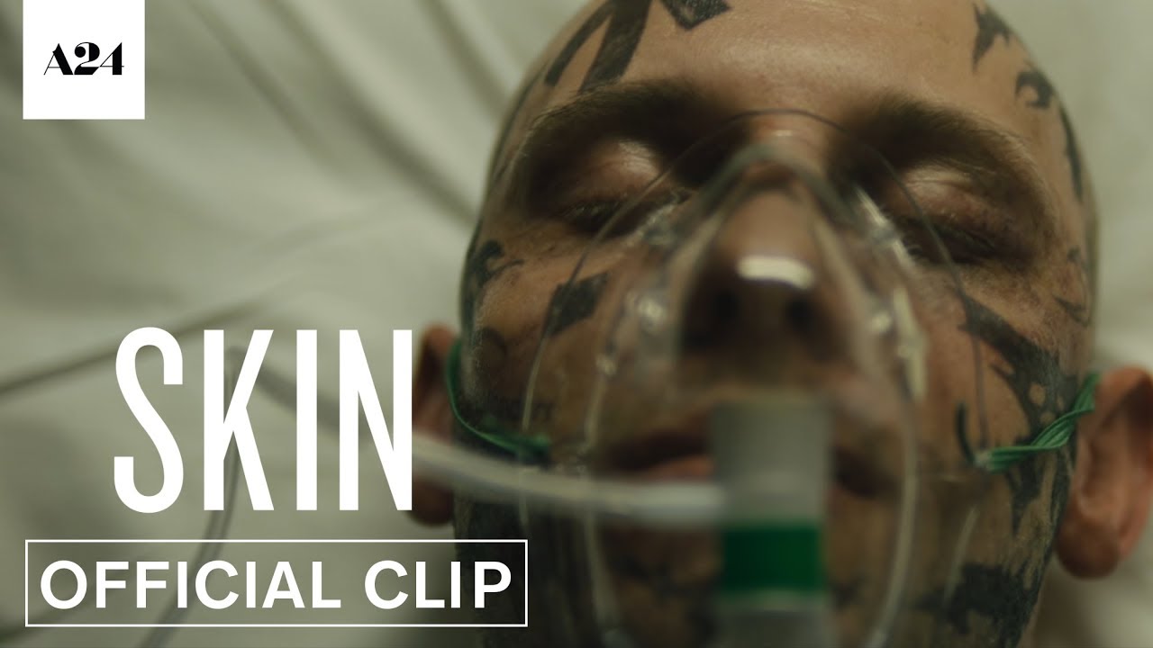 Watch film Skin | In the Hospital